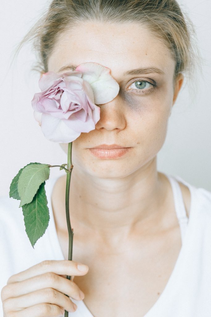 Donna con lividi e un fiore in mano, contro la violenza di genere